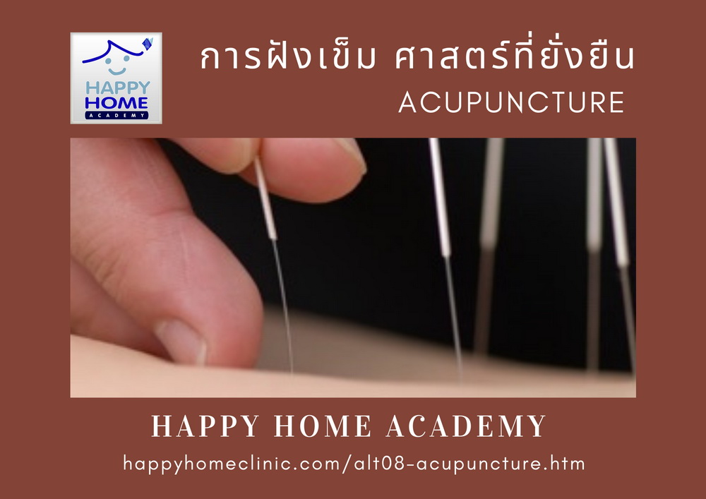 acupuncture