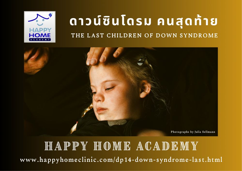 The last children of Down Syndrome