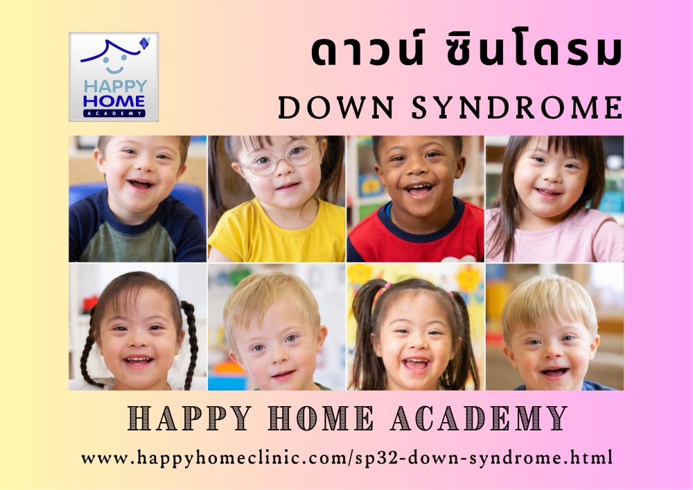Down Syndrome Down Syndrome